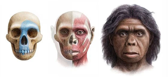 Mắt ở phía trước cũng có nguyên nhân của nó.